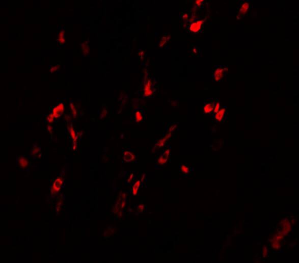 Immunocytochemistry/ Immunofluorescence: BCAS1 Antibody - BSA Free [NBP1-77123] - Immunofluorescence of BCAS1 in Human Breast Carcinoma cells with BCAS1 antibody at 20 u/mL.