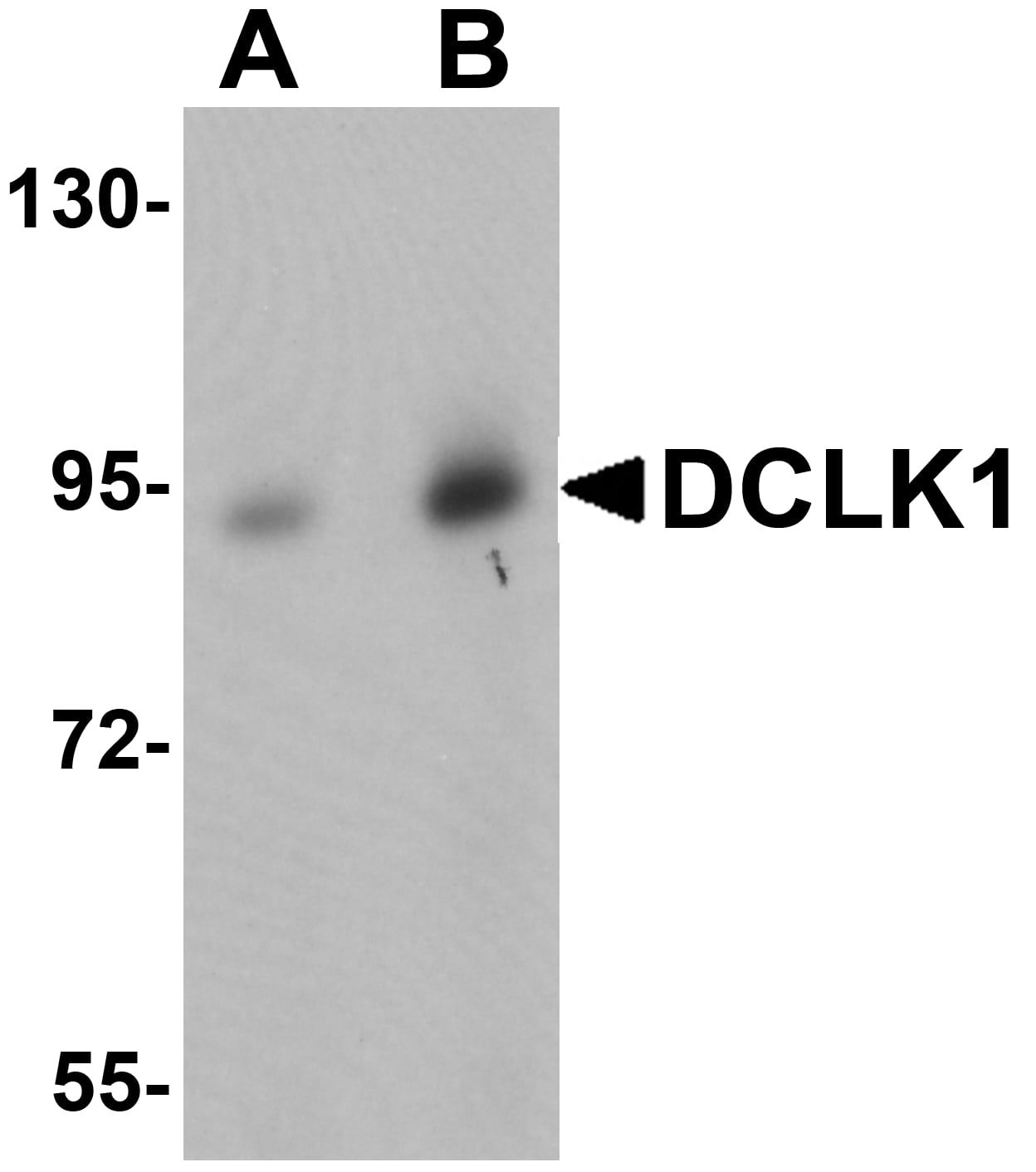 Western Blot DCLK1 Antibody - BSA Free