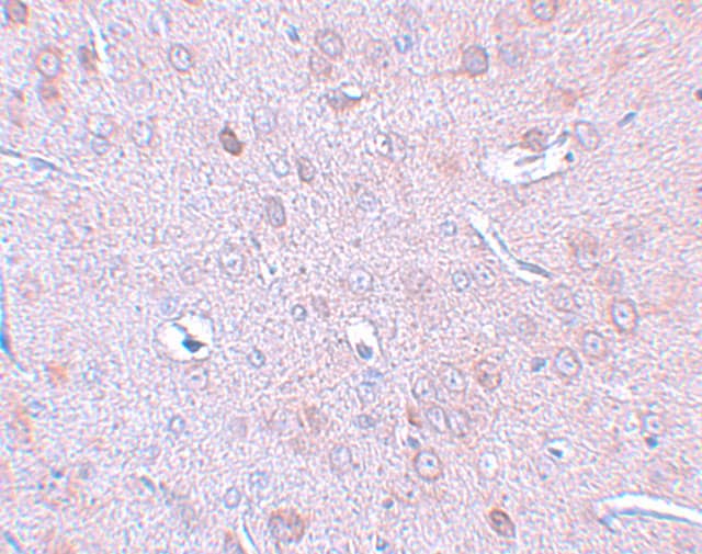 Immunohistochemistry DCLK1 Antibody - BSA Free