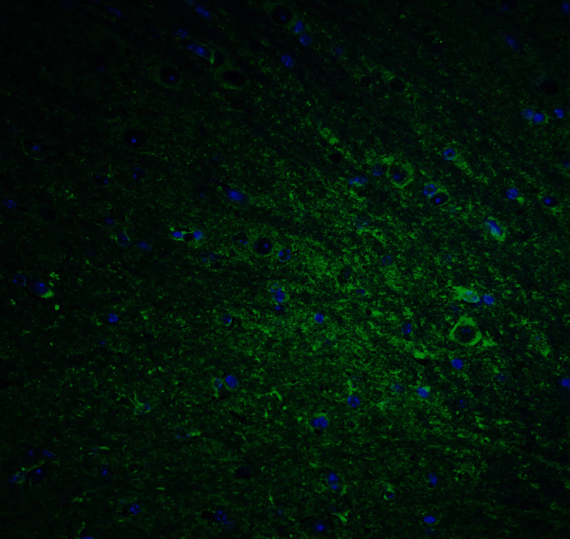 Immunocytochemistry/ Immunofluorescence DCLK1 Antibody - BSA Free