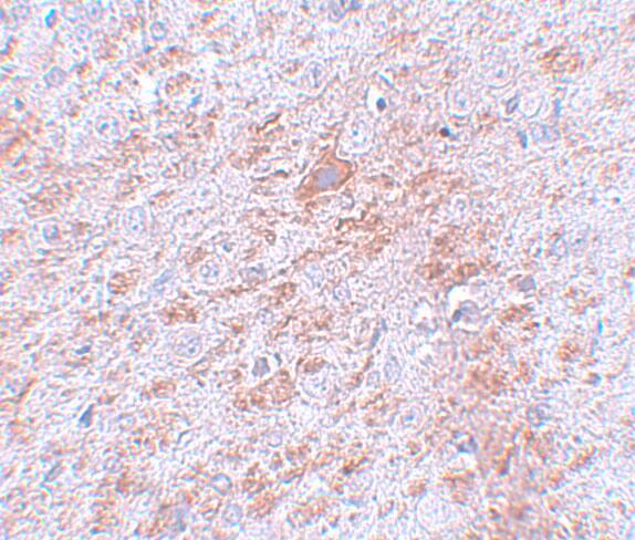 Immunohistochemistry DCAMKL2 Antibody - BSA Free