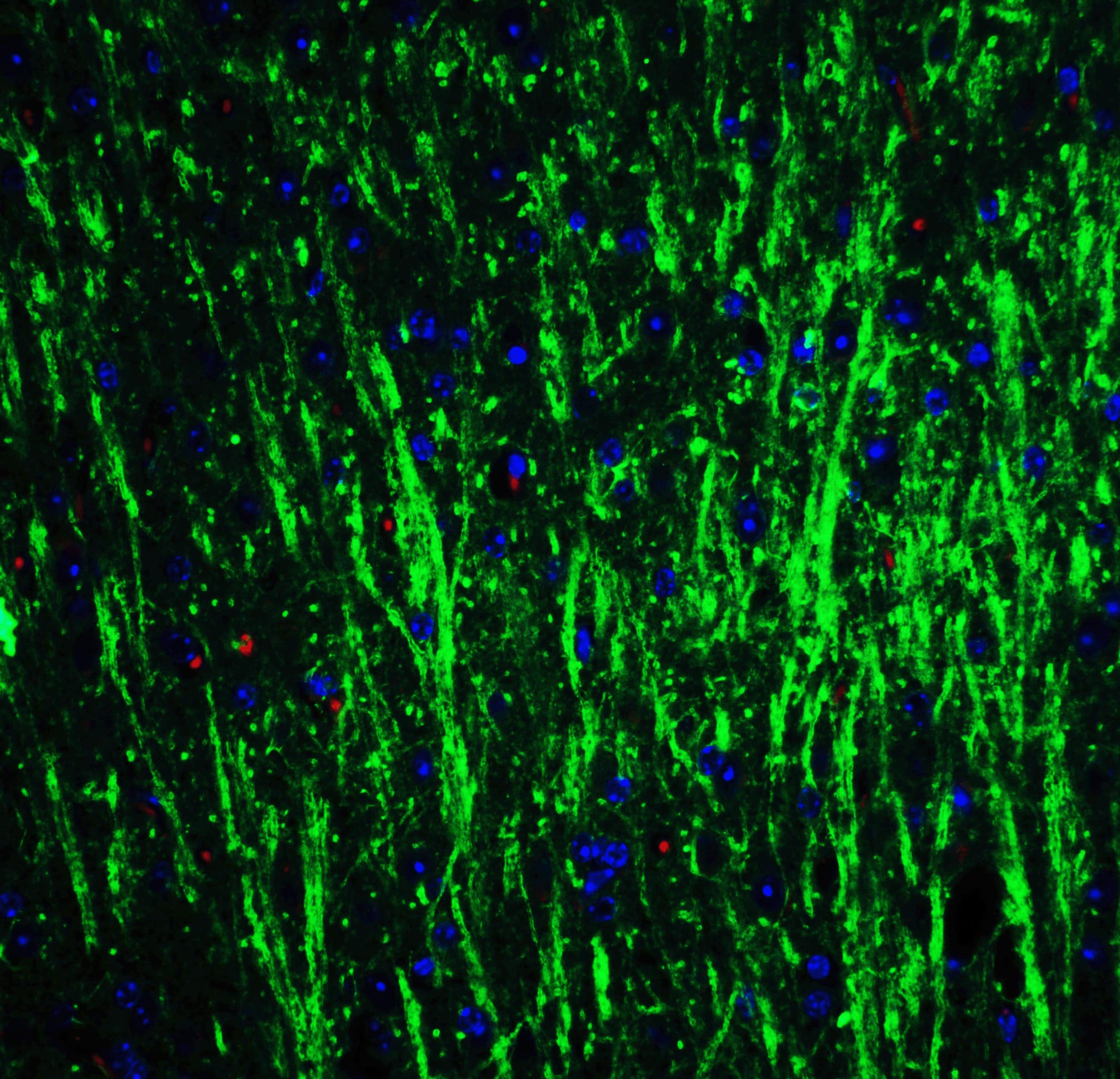 Immunocytochemistry/ Immunofluorescence DCLK3 Antibody - BSA Free