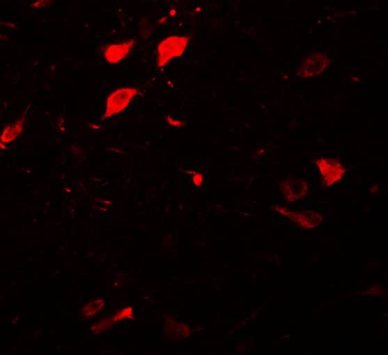 Immunocytochemistry/ Immunofluorescence DCLK3 Antibody - BSA Free