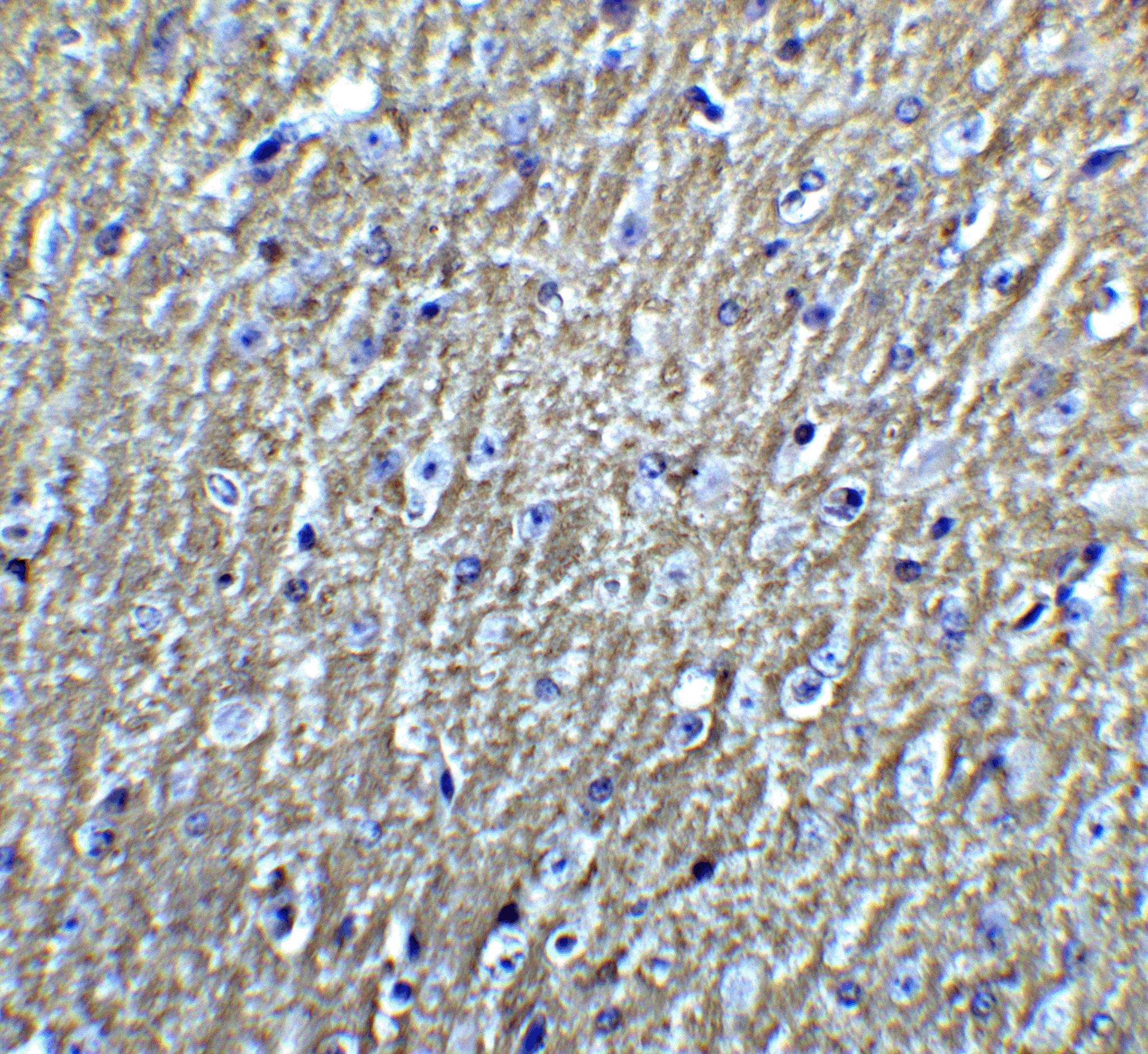 Immunohistochemistry DCLK3 Antibody - BSA Free