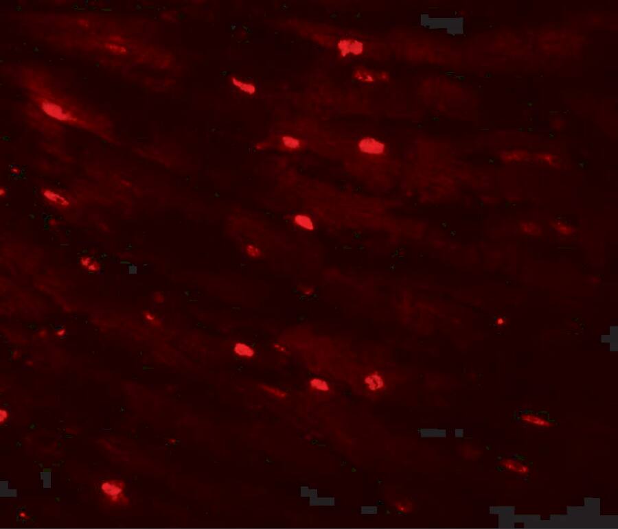 Immunocytochemistry/ Immunofluorescence: MTUS2 Antibody - BSA Free [NBP1-77130] - Immunofluorescence of MTUS2 in mouse heart tissue with MTUS2 antibody at 20 ug/mL.