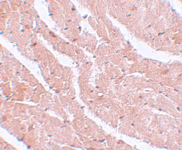 Immunohistochemistry: MTUS2 Antibody - BSA Free [NBP1-77130] - Immunohistochemistry of MTUS2 in mouse heart tissue with MTUS2 antibody at 5 ug/mL.