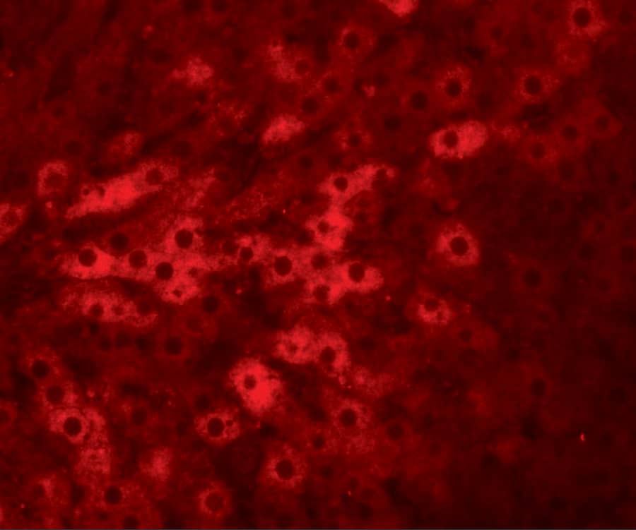 Immunocytochemistry/ Immunofluorescence TMEM70 Antibody - BSA Free