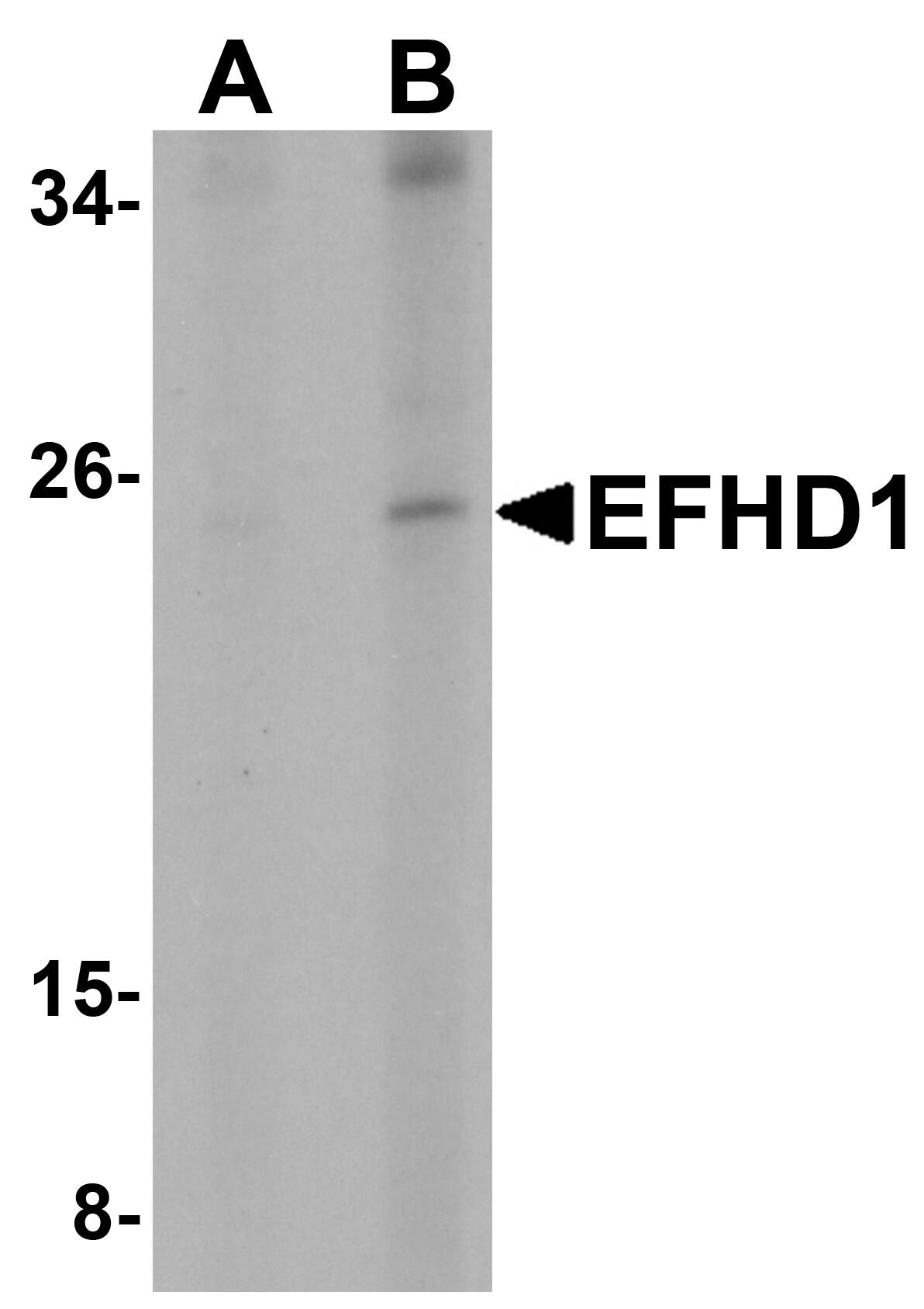 Western Blot: EFHD1 Antibody - BSA Free [NBP1-77134] - Western blot analysis of EFHD1 in human spleen tissue lysate with EFHD1 antibody at (A) 2 and (B) 4 u/mL.