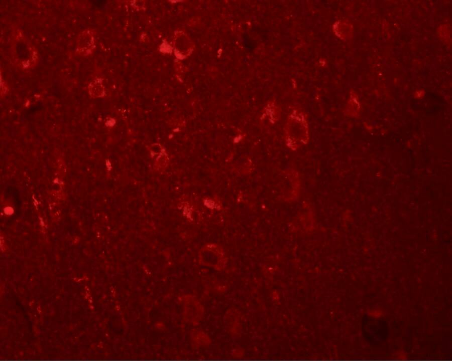 Immunocytochemistry/ Immunofluorescence: EFHD2 Antibody - BSA Free [NBP1-77135] - Immunofluorescence of EFHD2 in human brain tissue with EFHD2 antibody at 20 u/mL.