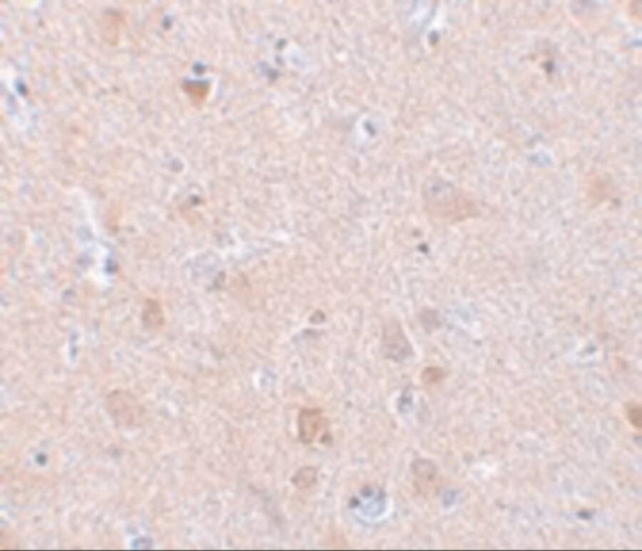 Immunohistochemistry EFHD2 Antibody - BSA Free