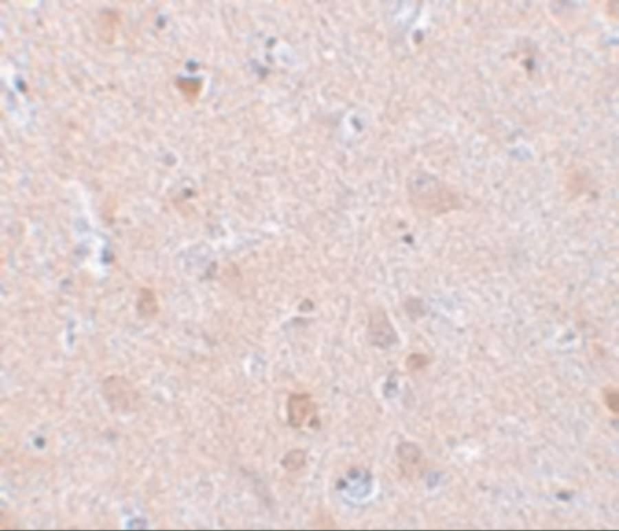 Immunohistochemistry EFHD2 Antibody - BSA Free