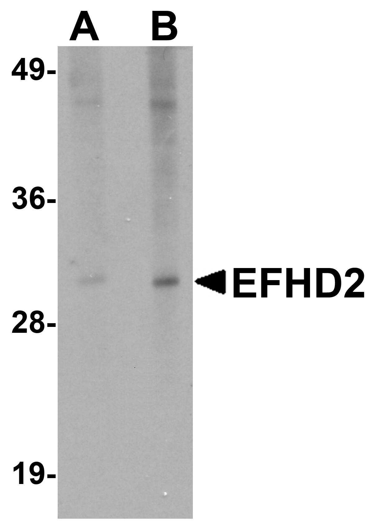 Western Blot: EFHD2 Antibody - BSA Free [NBP1-77135] - Western blot analysis of EFHD2 in mouse brain tissue lysate with EFHD2 antibody at (A) 1 and (B) 2 u/mL.