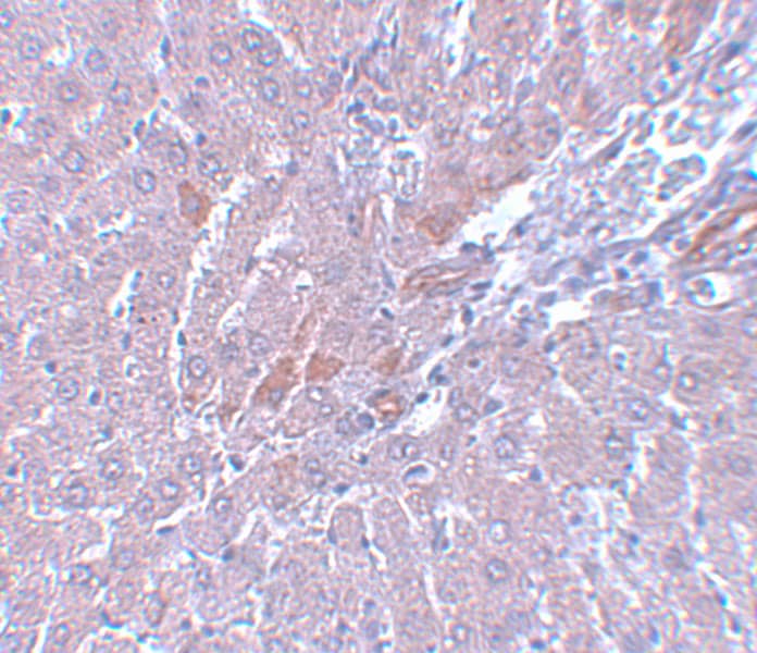 Immunohistochemistry: LYRM1 Antibody - BSA Free [NBP1-77136] - Immunohistochemistry of LYRM1 in rat liver tissue with LYRM1 antibody at 5 u/mL.