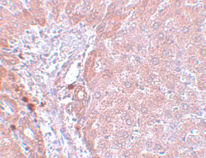 Immunohistochemistry: NDUFB9 Antibody - BSA Free [NBP1-77138] - Immunohistochemistry of NDUFB9 in rat liver tissue with NDUFB9 antibody at 5 ug/mL.