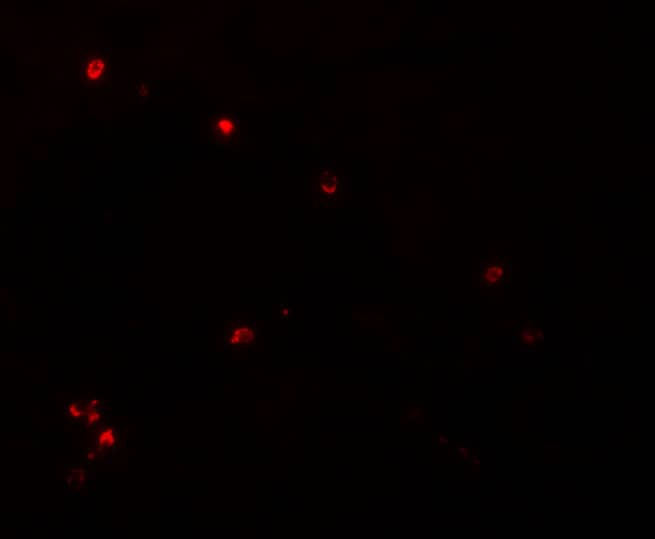 Immunocytochemistry/ Immunofluorescence: NDUFB9 Antibody - BSA Free [NBP1-77138] - Immunofluorescence of NDUFB9 in rat liver tissue with NDUFB9 antibody at 20 u/mL.
