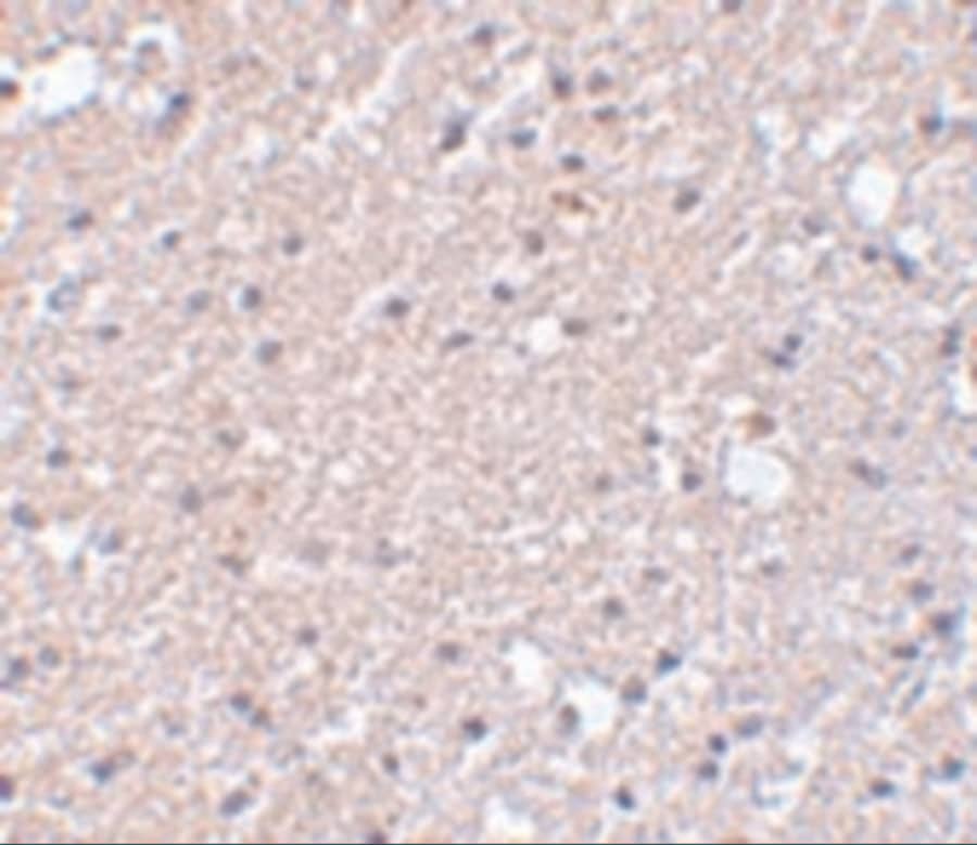 Immunohistochemistry: TMEM184A Antibody - BSA Free [NBP1-77142] - Immunohistochemistry of TMEM184A in human brain tissue with TMEM184A antibody at 5 ug/mL.