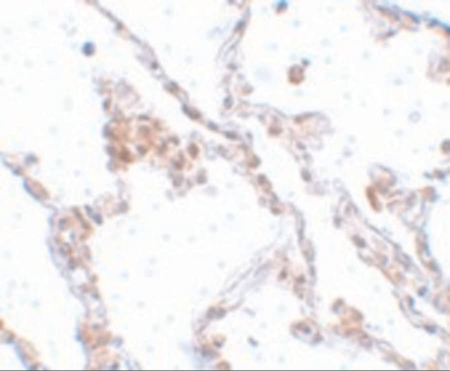 Immunohistochemistry: TMEM184B Antibody - BSA Free [NBP1-77143] - Immunohistochemistry of TMEM184B in human lung tissue with TMEM184B antibody at 5 ug/mL.