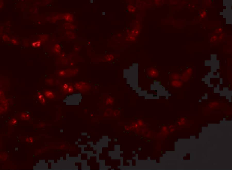 Immunocytochemistry/ Immunofluorescence: TMEM184B Antibody - BSA Free [NBP1-77143] - Immunofluorescence of TMEM184B in human lung tissue with TMEM184B antibody at 20 u/mL.