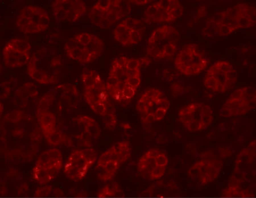 Immunocytochemistry/ Immunofluorescence ENC1 Antibody - BSA Free