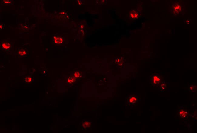 Immunocytochemistry/ Immunofluorescence: KLHL25 Antibody - BSA Free [NBP1-77147] - Immunofluorescence of KLHL25 in Jurkat cells with KLHL25 antibody at 20 u/mL.