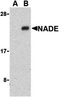 Western Blot: NGFRAP1/BEX3/NADE Antibody - BSA Free [NBP1-77149] - Western blot analysis of NGFRAP1/BEX3/NADE in Human brain cell lysates with NGFRAP1/BEX3/NADE antibody at 1 u/mL in the presence (A) or absence (B) of blocking peptide. 