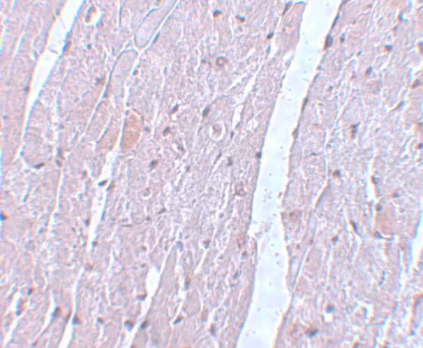 Immunohistochemistry: Apc10 Antibody - BSA Free [NBP1-77157] - Immunohistochemistry of Apc10 in mouse heart tissue with Apc10 antibody at 5 u/mL.