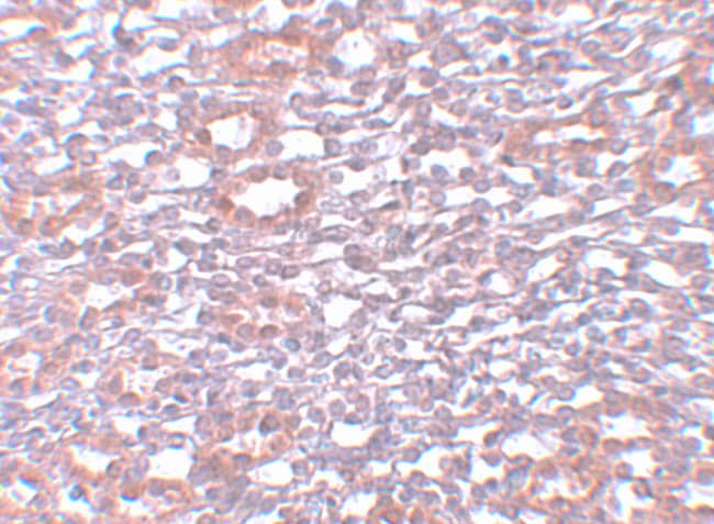 Immunohistochemistry: PIAS1 Antibody - BSA Free [NBP1-77158] - Immunohistochemistry of PIAS1 in rat kidney tissue with PIAS1 antibody at 5 u/mL.