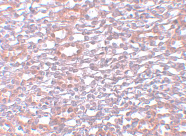 Immunohistochemistry: PIAS1 Antibody - BSA Free [NBP1-77158] - Immunohistochemistry of PIAS1 in rat kidney tissue with PIAS1 antibody at 5 u/mL.