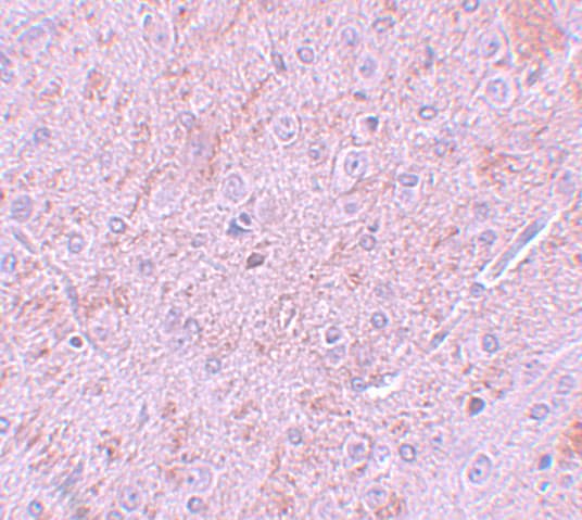 Immunohistochemistry: PIAS2 Antibody - BSA Free [NBP1-77159] - Immunohistochemistry of PIAS2 in rat brain tissue with PIAS2 antibody at 5 u/mL.