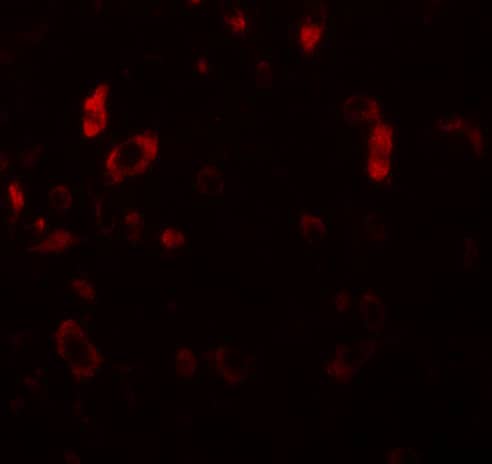 Immunocytochemistry/ Immunofluorescence: PIAS2 Antibody - BSA Free [NBP1-77159] - Immunofluorescence of PIAS2 in rat brain tissue with PIAS2 antibody at 20 u/mL.