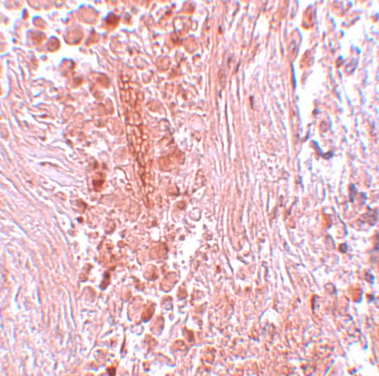 Immunohistochemistry PIAS3 Antibody - BSA Free