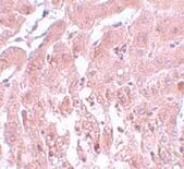 Immunohistochemistry SUMO2 Antibody - BSA Free