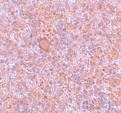 Immunohistochemistry: CtIP Antibody - BSA Free [NBP1-77165] - Immunohistochemistry of CtIP in rat spleen tissue with CtIP antibody at 5 ug/mL.