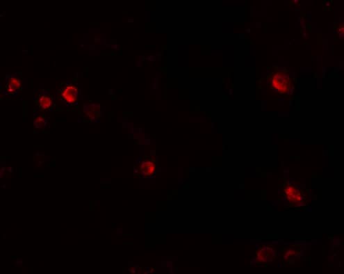 Immunocytochemistry/ Immunofluorescence: USP10 Antibody - BSA Free [NBP1-77170] - Immunofluorescence of USP10 in Jurkat cells with USP10 antibody at 20 u/mL.