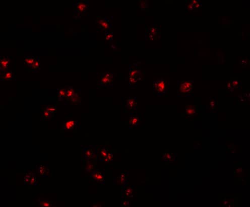 Immunocytochemistry/ Immunofluorescence: IFITM1 Antibody - BSA Free [NBP1-77171] - Immunofluorescence of IFITM1 in Jurkat cells with IFITM1 antibody at 20 ug/mL.