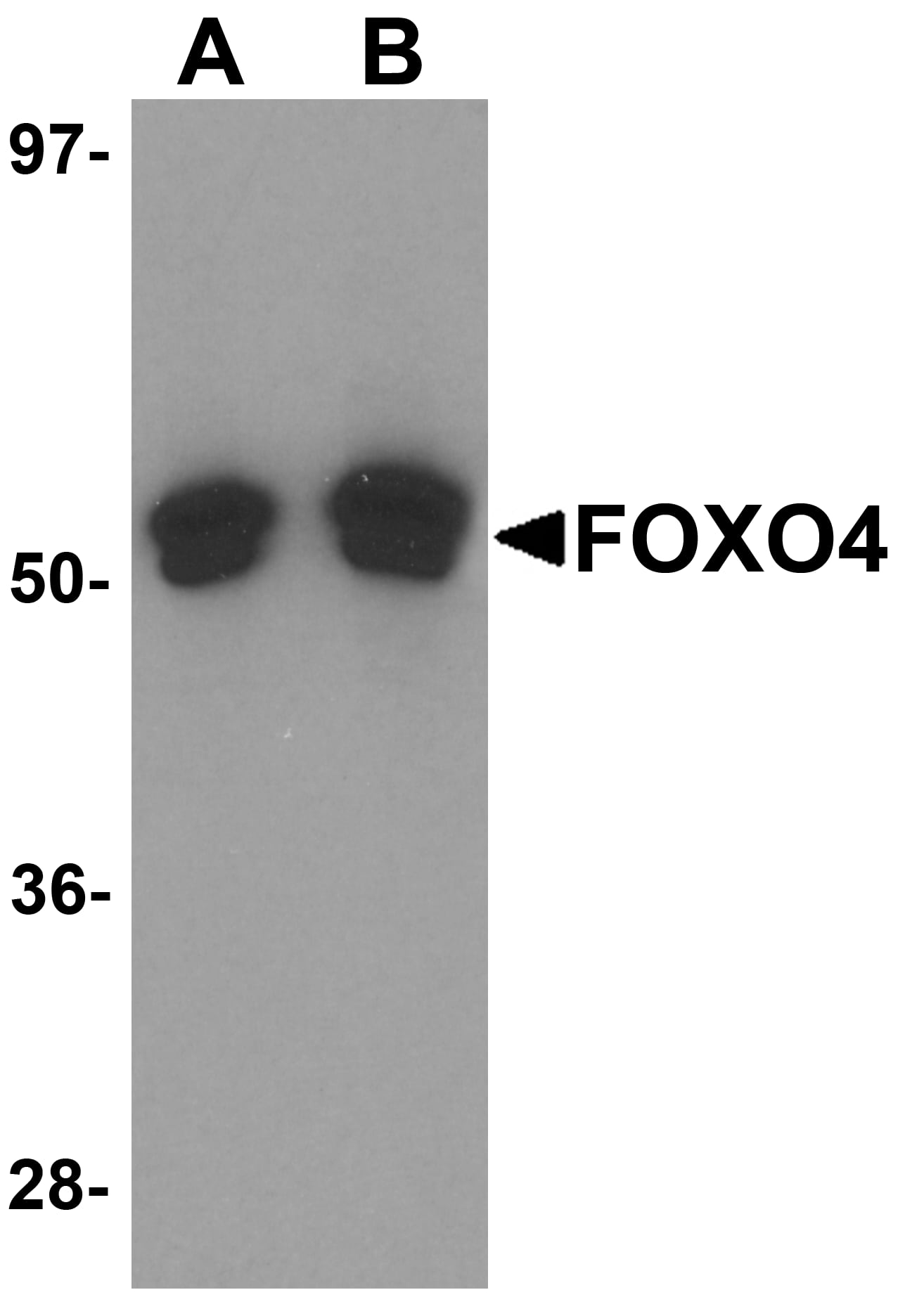 Western Blot FOXO4 Antibody - BSA Free