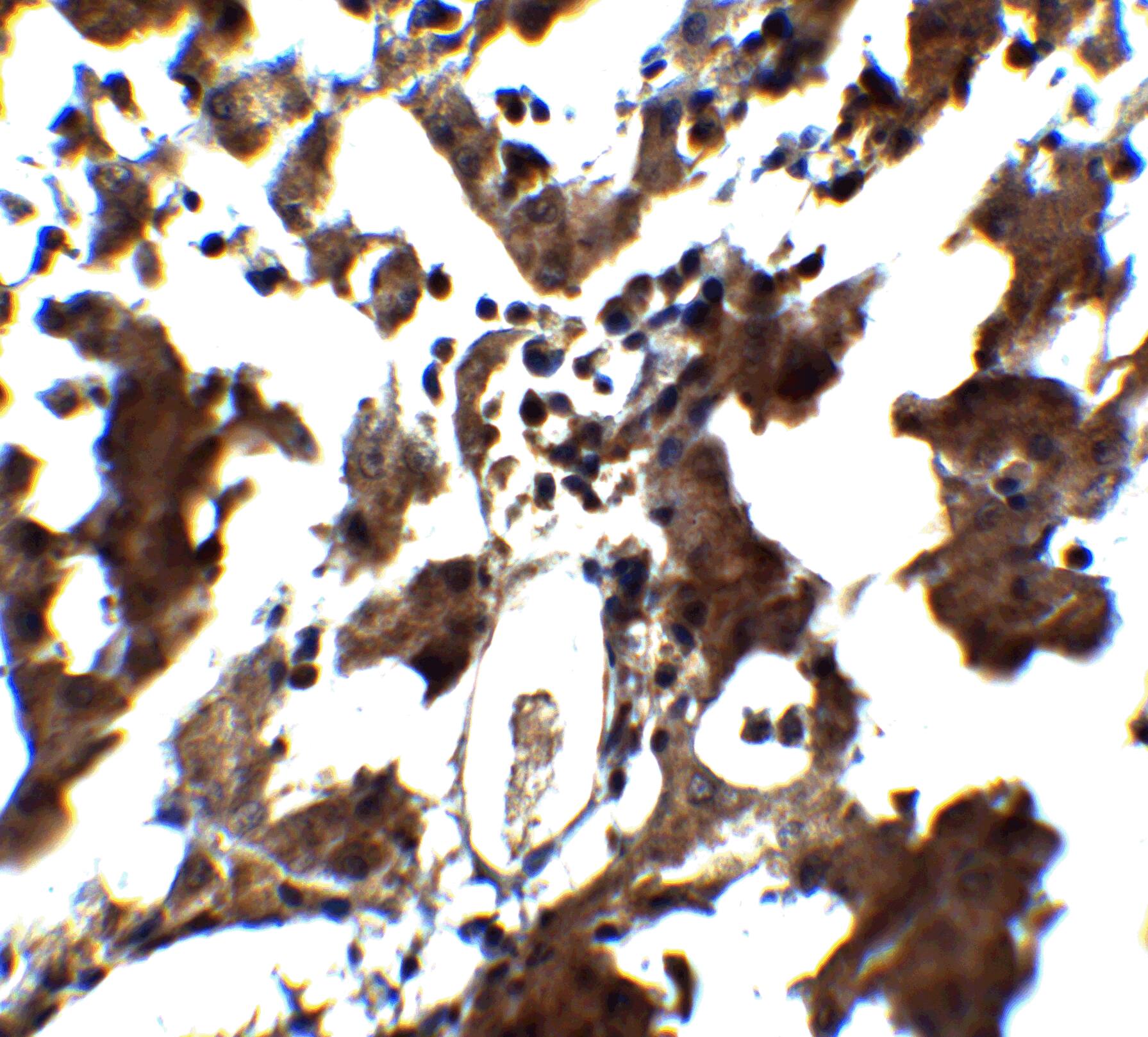 Immunohistochemistry: ZEB1 Antibody - BSA Free [NBP1-77178] - Immunohistochemistry of ZEB1 in human liver tissue with ZEB1 antibody at 5 u/mL.