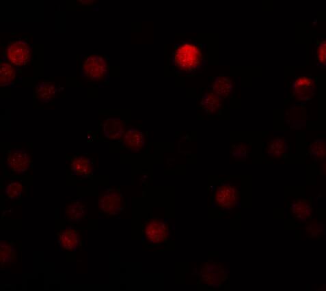 Immunocytochemistry/ Immunofluorescence: ZEB1 Antibody - BSA Free [NBP1-77178] - Immunofluorescence of ZEB1 in Hela cells with ZEB1 antibody at 20 u/mL.