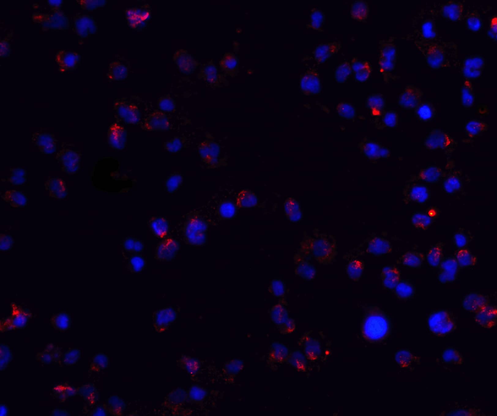 Immunocytochemistry/ Immunofluorescence: ZEB2 Antibody - BSA Free [NBP1-77179] - Immunofluorescence of ZEB2 in Jurkat cells with ZEB2 antibody at 20 ug/ml.Red: ZEB2 Antibody   Blue: DAPI staining