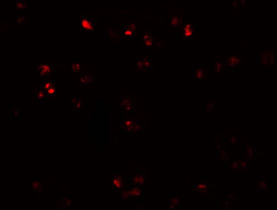 Immunocytochemistry/ Immunofluorescence: ZEB2 Antibody - BSA Free [NBP1-77179] - Immunofluorescence of ZEB2 in Jurkat cells with ZEB2 antibody at 20 u/mL.