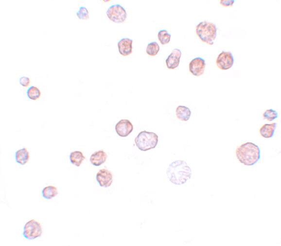 Immunocytochemistry/ Immunofluorescence: QBRICK/FREM1 Antibody - BSA Free [NBP1-77180] - Immunocytochemistry of QBRICK/FREM1 in K562 cells with QBRICK/FREM1 antibody at 20 u/mL.