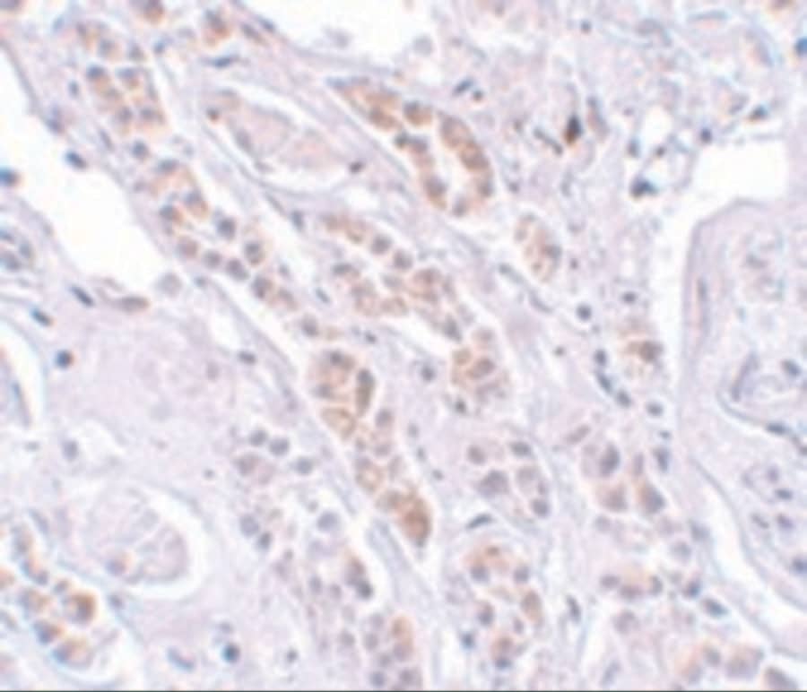 Immunohistochemistry TCTN1 Antibody - BSA Free