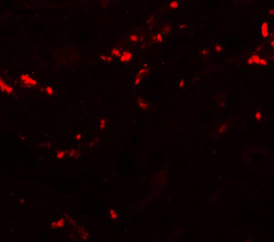 Immunocytochemistry/ Immunofluorescence TCTN1 Antibody - BSA Free