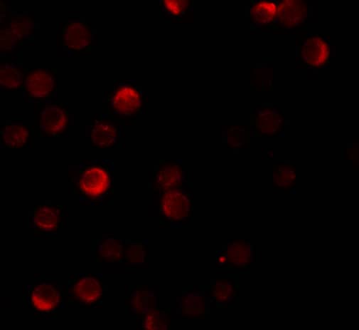 Immunocytochemistry/ Immunofluorescence ZCCHV Antibody - BSA Free