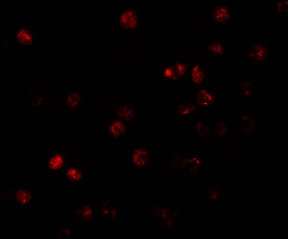 Immunocytochemistry/ Immunofluorescence ATP11B Antibody - BSA Free