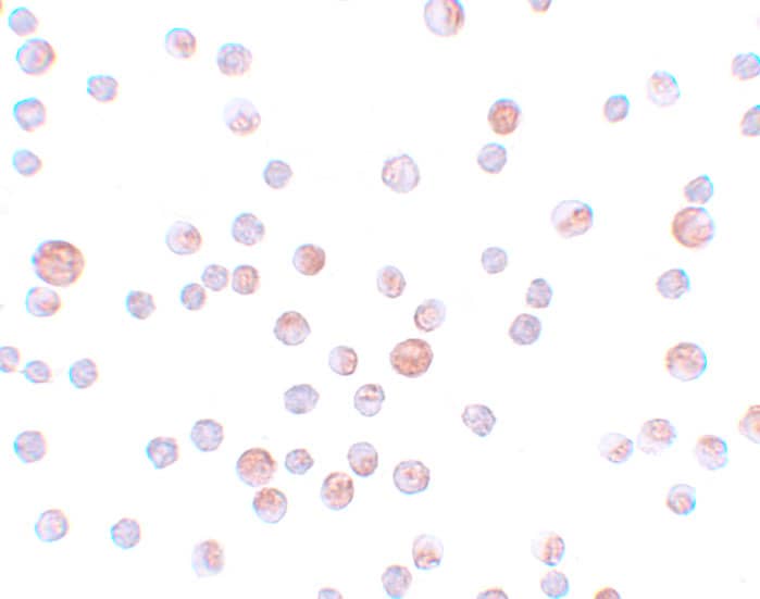 Immunocytochemistry/ Immunofluorescence: CABP7 Antibody - BSA Free [NBP1-77191] - Immunocytochemistry of CABP7 in HeLa cells with CABP7 antibody at 4 u/mL.