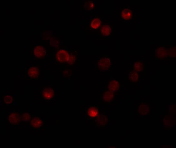 Immunocytochemistry/ Immunofluorescence: CABP7 Antibody - BSA Free [NBP1-77191] - Immunofluorescence of CABP7 in HeLa cells with CAPB7 antibody at 20 ug/mL.