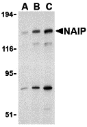 Western Blot: NAIP Antibody - BSA Free [NBP1-77196] - Western blot analysis of NAIP in human tonsil tissue lysate with NAIP antibody at 1 ug/mL.