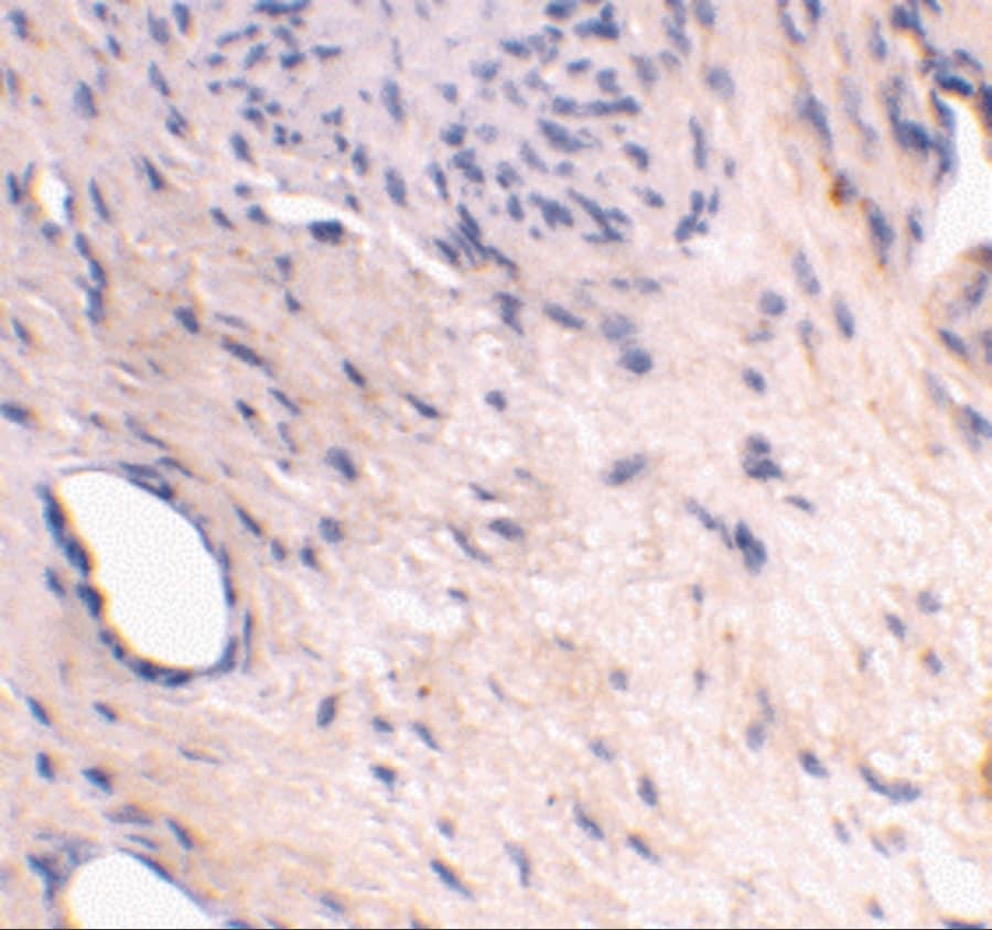 Immunohistochemistry ARMER Antibody - BSA Free