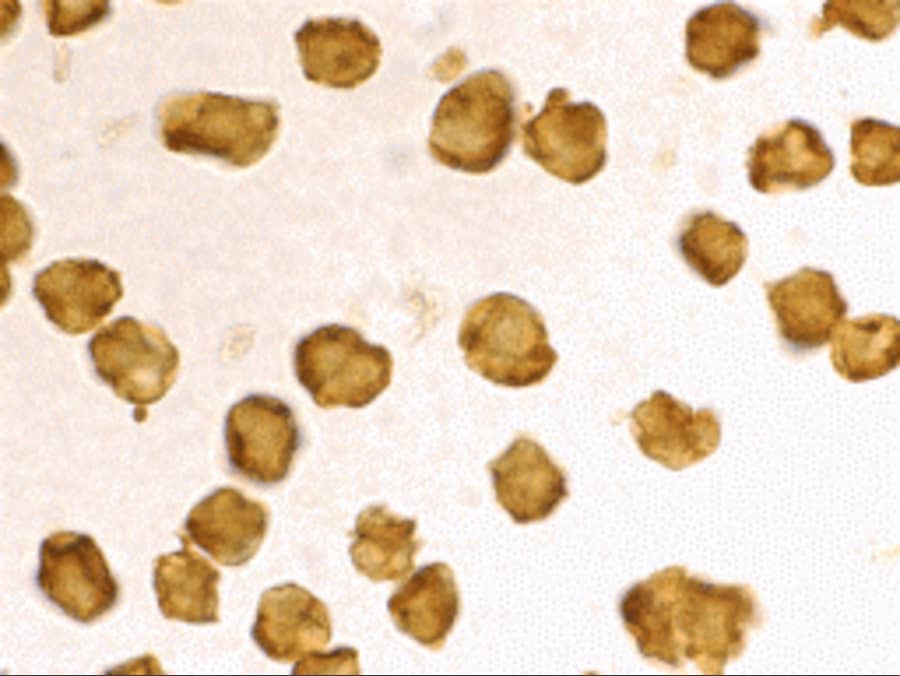 Immunocytochemistry/ Immunofluorescence: SARM1 Antibody - BSA Free [NBP1-77200] - Immunocytochemistry staining of Daudi cells using SARM1 antibody at 2 u/mL.